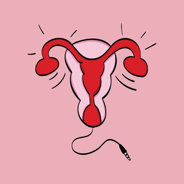 Baarmoederverhalen - De Podcast